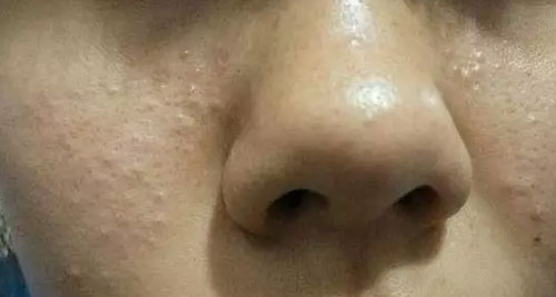 Ĥ׌ڼҲ坍SPA