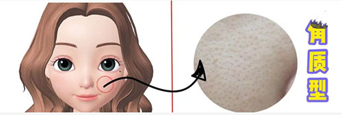 |ë